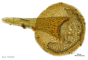 <i>Seligeria pusilla</i> (Hedw.) Bruch & Schimp., 1846 © H. TINGUY