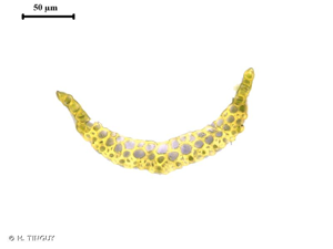 <i>Campylopus fragilis</i> (Brid.) Bruch & Schimp., 1847 © H. TINGUY
