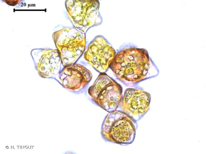 <i>Anastrophyllum minutum</i> (Schreb.) R.M.Schust., 1949 © H. TINGUY