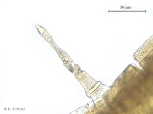 <i>Orthotrichum stramineum</i> Hornsch. ex Brid., 1827 © H. TINGUY