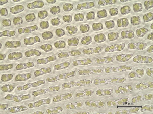 <i>Ptychomitrium polyphyllum</i> (Dicks. ex Sw.) Bruch & Schimp., 1837 © H. TINGUY