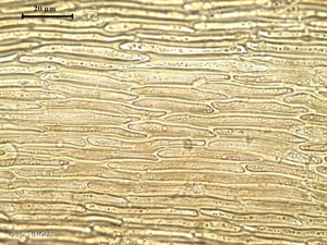 <i>Palustriella falcata</i> (Brid.) Hedenäs, 1992 © H. TINGUY