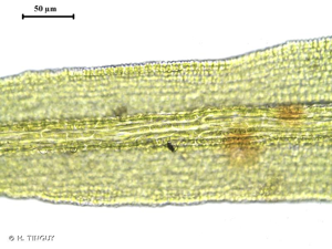 <i>Didymodon insulanus</i> (De Not.) M.O.Hill, 1981 © H. TINGUY