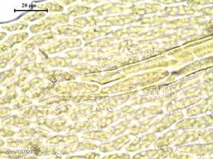 <i>Microeurhynchium pumilum</i> (Wilson) Ignatov & Vanderp., 2009 © H. TINGUY