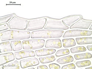 <i>Trichostomum brachydontium</i> Bruch, 1829 © H. TINGUY