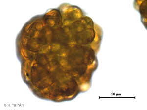 <i>Grimmia hartmanii</i> Schimp., 1860 © H. TINGUY