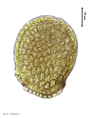 <i>Frullania fragilifolia</i> (Taylor) Gottsche, Lindenb. & Nees, 1845 © H. TINGUY