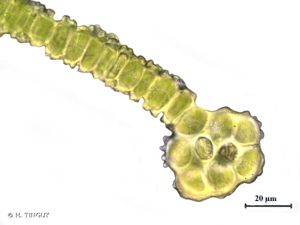 <i>Dialytrichia mucronata</i> (Brid.) Broth., 1902 © H. TINGUY