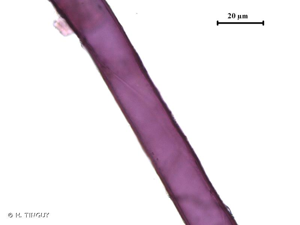 <i>Fossombronia angulosa</i> (Dicks.) Raddi, 1818 © H. TINGUY