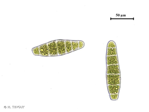 <i>Zygodon conoideus</i> (Dicks.) Hook. & Taylor, 1818 © H. TINGUY