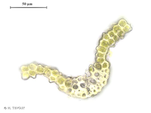 <i>Cynodontium bruntonii</i> (Sm.) Bruch & Schimp., 1846 © H. TINGUY