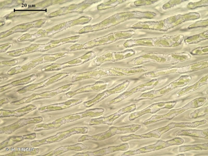 <i>Campylopus atrovirens</i> De Not., 1838 © H. TINGUY