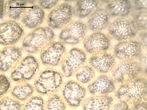 <i>Saccogyna viticulosa</i> (L.) Dumort., 1831 © H. TINGUY