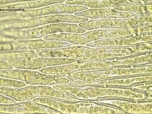 <i>Pohlia bulbifera</i> (Warnst.) Warnst., 1904 © H. TINGUY