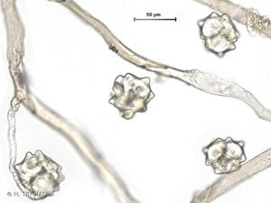 <i>Pohlia lutescens</i> (Limpr.) H.Lindb., 1899 © H. TINGUY
