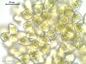 <i>Lophozia ascendens</i> (Warnst.) R.M.Schust., 1952 © H. TINGUY