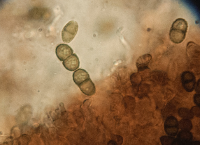 Calicium glaucellum, DMS-9167319 &copy; Thomas Læssøe