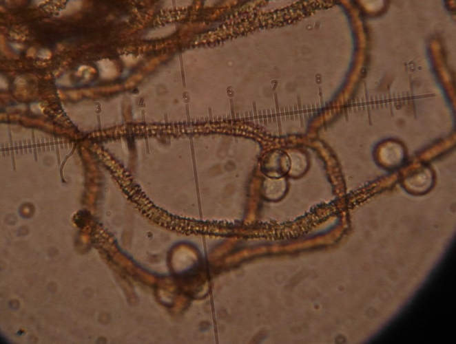 Arcyria cinerea (Bull.) Pers., 1801 &copy; Tjerk Nawijn