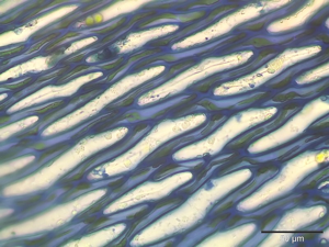 Sphagnum flexuosum stammblatt zellen.jpeg © Kristian Peters Fabelfroh 11:43, 15 September 2007 (UTC)
