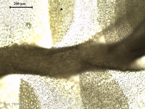 <i>Pedinophyllum interruptum</i> (Nees) Kaal., 1893 © H. TINGUY