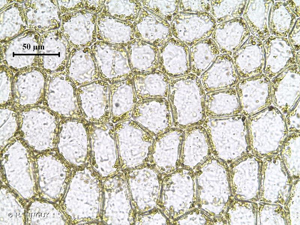 <i>Mesoptychia turbinata</i> (Raddi) L.Söderstr. & Váňa, 2012 © H. TINGUY