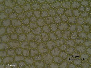 <i>Solenostoma sphaerocarpum</i> (Hook.) Steph., 1901 © H. TINGUY