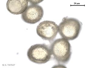 <i>Tortula truncata</i> (Hedw.) Mitt., 1870 © H. TINGUY