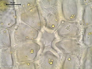 <i>Orthotrichum scanicum</i> Grönvall, 1885 © H. TINGUY