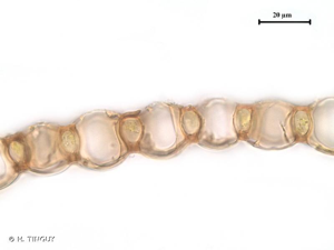<i>Sphagnum auriculatum</i> Schimp., 1857 © H. TINGUY