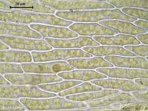 <i>Bryum ruderale</i> Crundw. & Nyholm, 1963 © H. TINGUY
