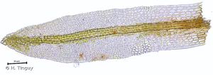 <i>Gyroweisia tenuis</i> (Hedw.) Schimp., 1876 © H. Tinguy