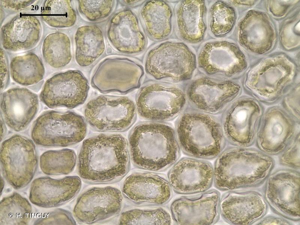 <i>Harpalejeunea molleri</i> (Steph.) Grolle, 1989 © H. TINGUY
