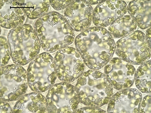 <i>Mesoptychia bantriensis</i> (Hook.) L.Söderstr. & Váňa, 2012 © H. TINGUY