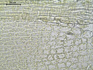 <i>Bryum radiculosum</i> Brid., 1817 © H. TINGUY
