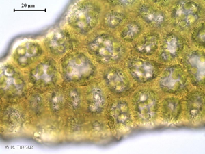 <i>Douinia ovata</i> (Dicks.) H.Buch, 1928 © H. TINGUY