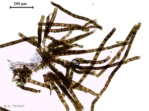 <i>Ptychostomum moravicum</i> (Podp.) Ros & Mazimpaka, 2013 © H. TINGUY