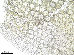 <i>Gymnomitrion concinnatum</i> (Lightf.) Corda, 1830 © H. TINGUY
