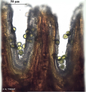 <i>Pogonatum aloides</i> (Hedw.) P.Beauv., 1805 © H. TINGUY