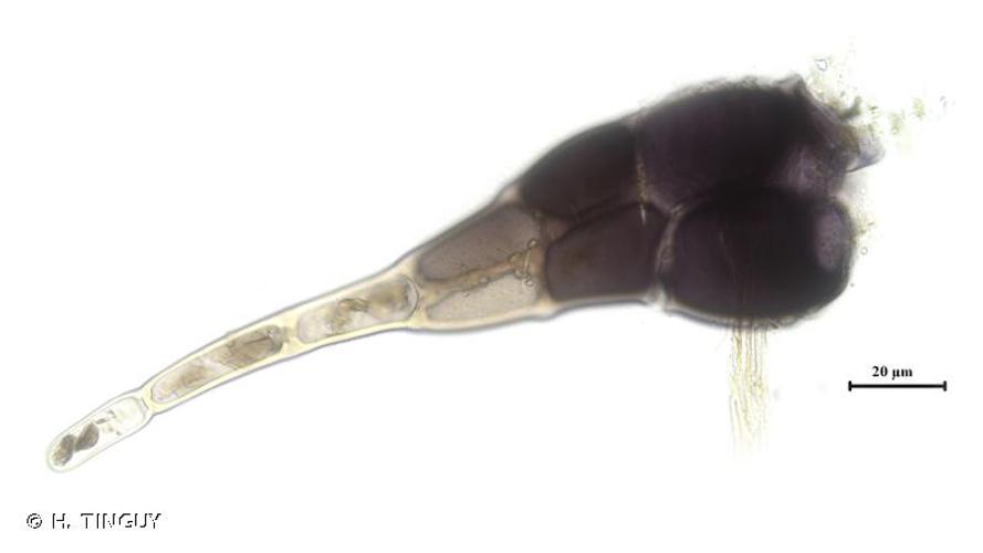<i>Leiomylia anomala</i> (Hook.) J.J.Engel & Braggins, 2005 © H. TINGUY